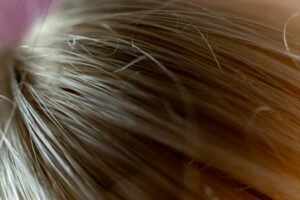 Ghid vizual despre cum să alegi peruci pentru alopecie potrivite pentru scalp sensibil 